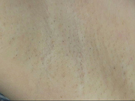 300人の腋 2　サンプル画像12